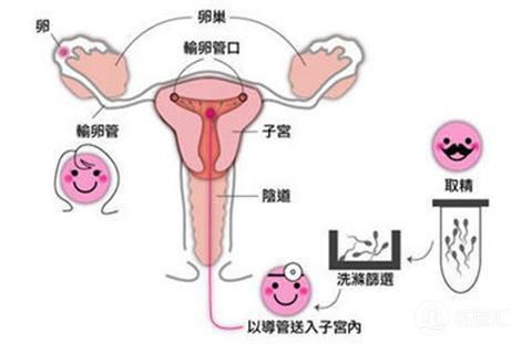 一次疏忽，一生的遗憾产检缺失背后的输卵管丧失悲剧