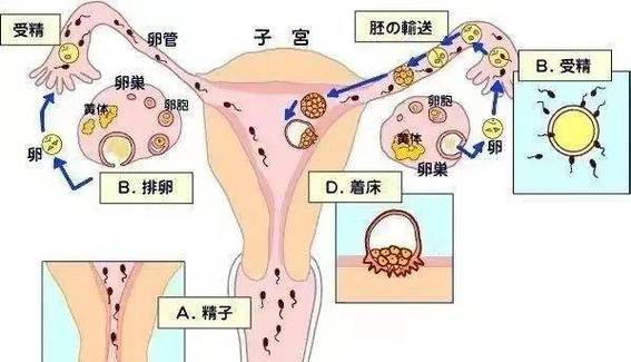 宫外怀孕的最佳处理方法综合治疗与个体化策略