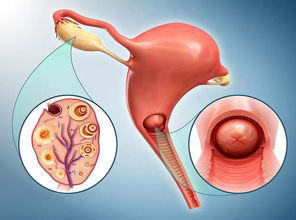 探究宫颈成熟度不佳的成因与影响