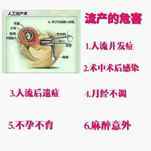 引产的全部过程图