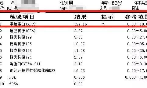 周报甲胎蛋白偏高情况分析及处理建议